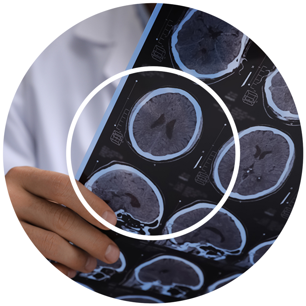 A doctor in a white coat holds a sheet of brain scan images, focusing on one highlighted with a black circle. The mood is clinical and analytical.