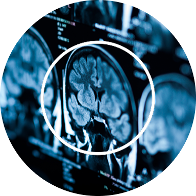 The Special Operations Forces Brain Health Initiative
